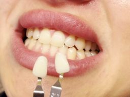 aesthetics treatments